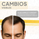 SHAMPOO CON MINOXIDIL Y COLÁGENO PARA CRECIMIENTO DE CABELLO